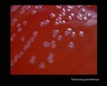 neisseria gonorrhoeae